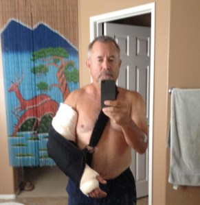 Post_Bicep_Surgery_Crop